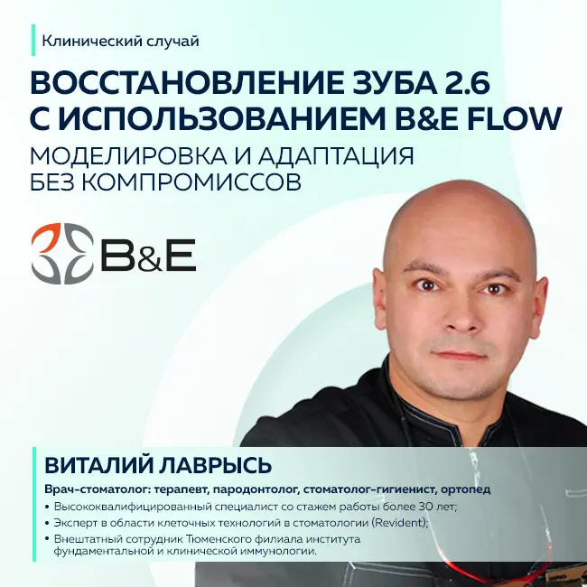 Восстановление зуба 2.6 с использованием B&E Flow: моделировка и адаптация без компромиссов 