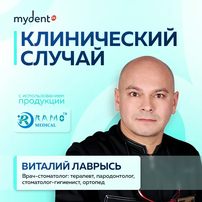 Лечение в экстремальных условиях: как работать с пациентом с ограниченным открыванием рта