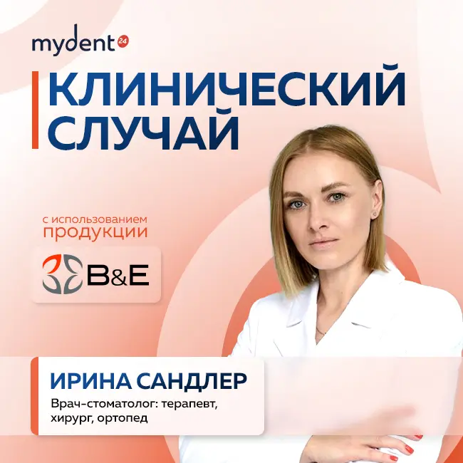 От дефекта к совершенству: искусство прямой реставрации с Xs-Fil