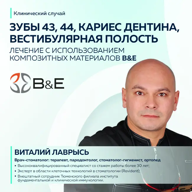 Виталий Лаврысь: “43, 44 зубы, кариес дентина, вестибулярная полость”