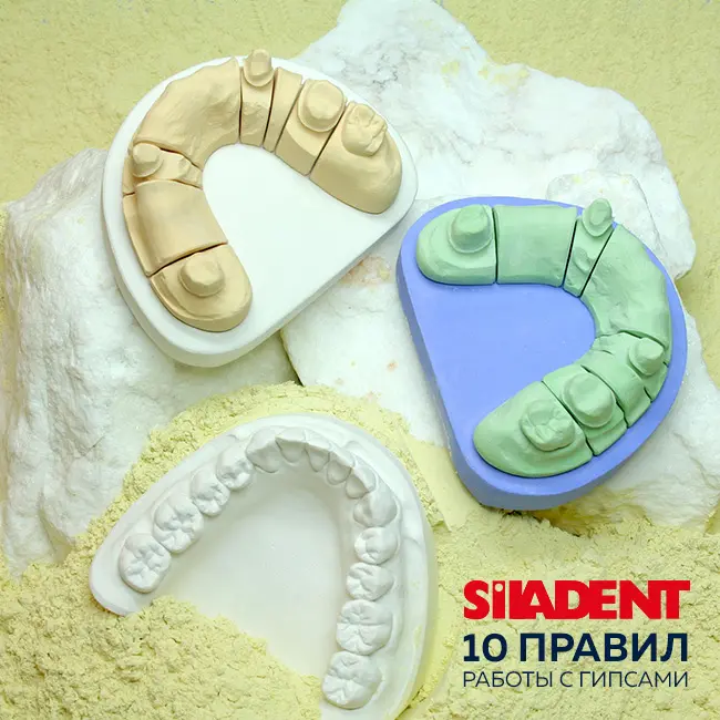 10 рекомендаций по работе с гипсами Siladent