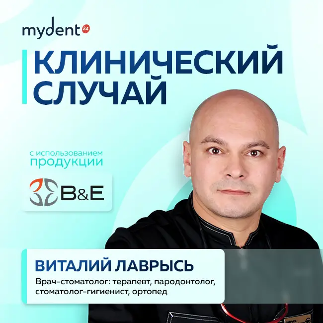 B&E Flow в действии: секреты идеальной моделировки жевательной группы