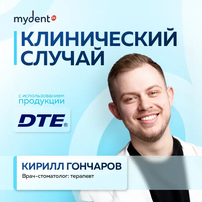 Облитерация каналов: не приговор! Как DTE D600 спасает сложные зубы