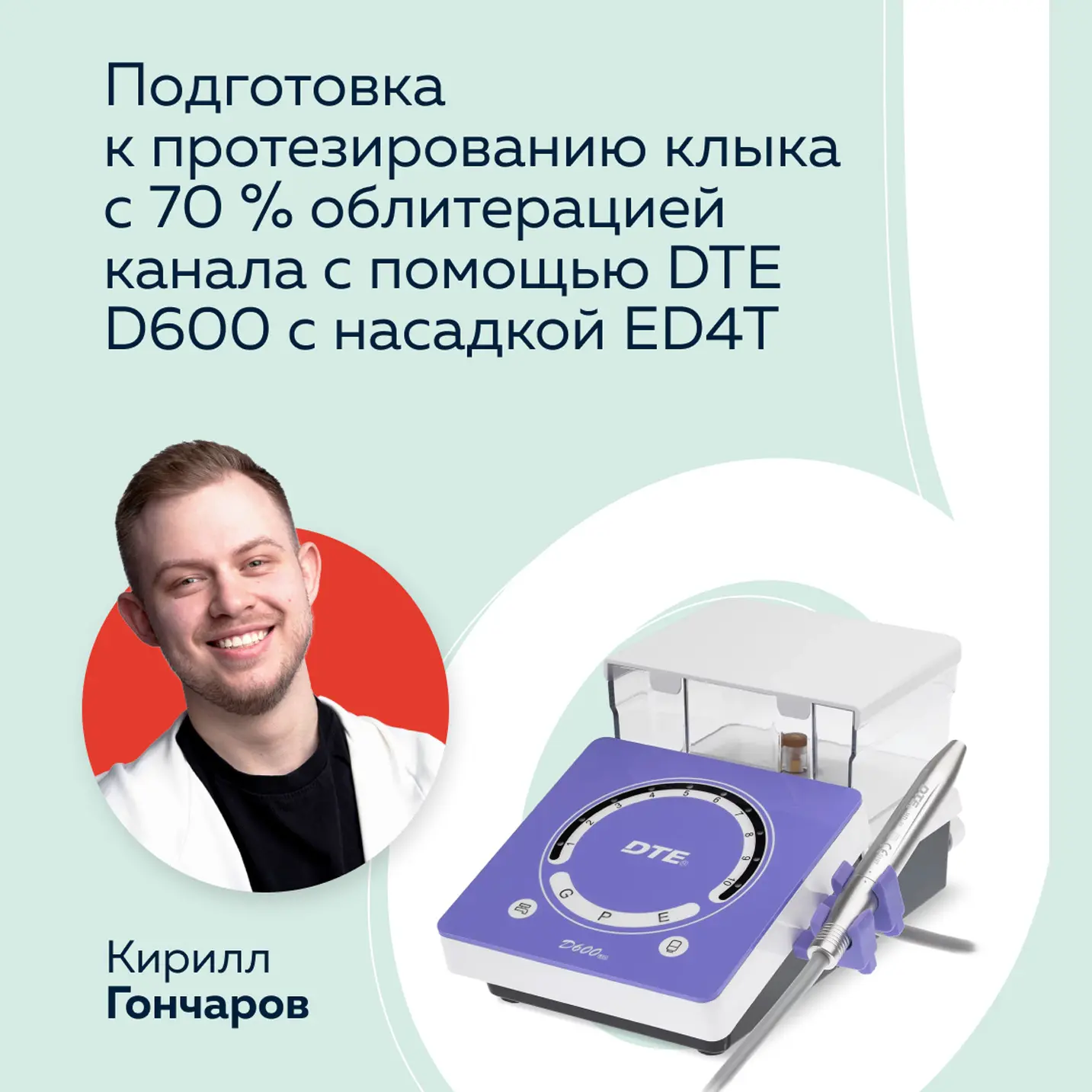 Клинический случай: прохождение облитерированного канала клыка