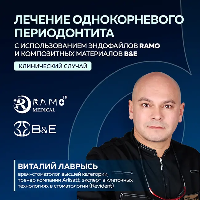 Периодонтит, один корень, один корневой канал 