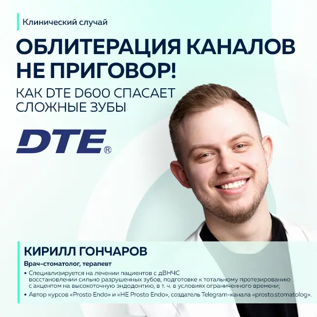 Облитерация каналов: не приговор! Как DTE D600 спасает сложные зубы